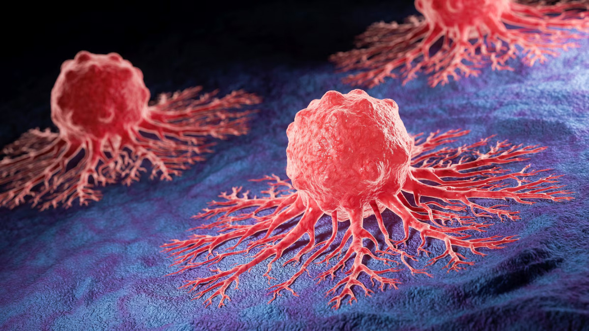 DZWS26DDLNARRD3STITQPZF4QI